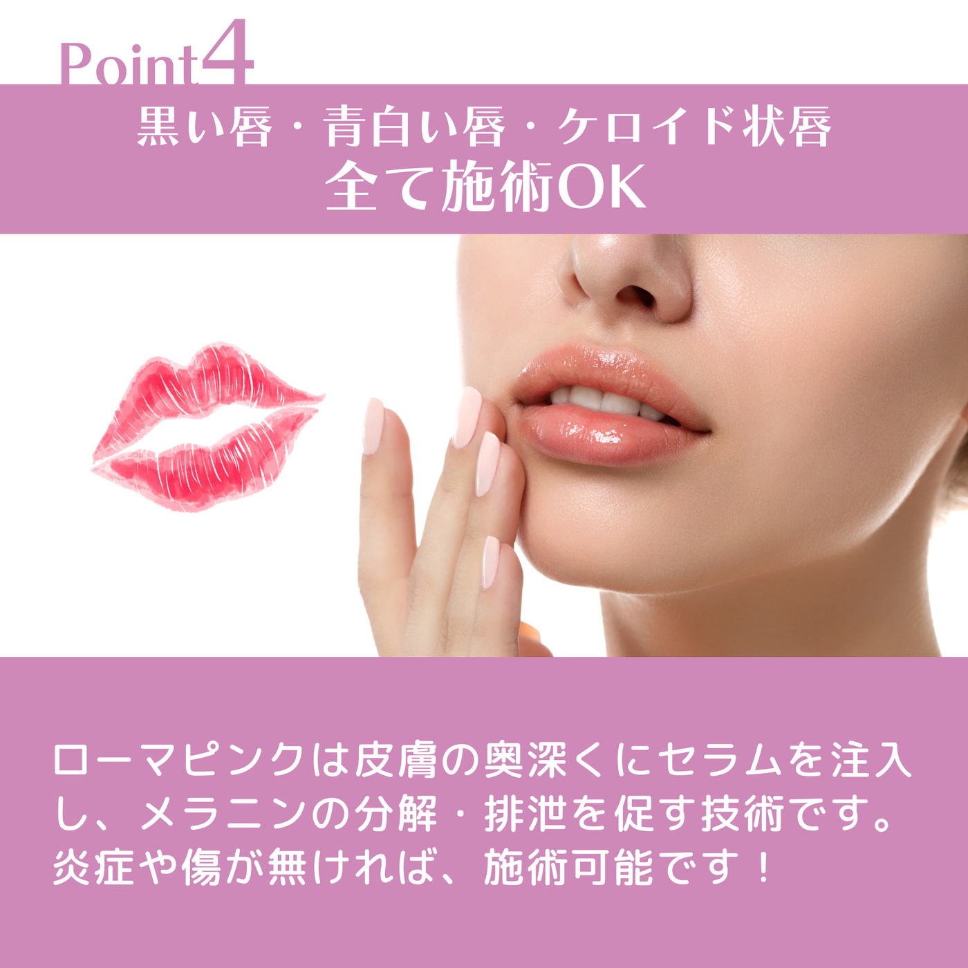 RomaPinkローマピンク リップ＆ボディ-愛媛県西条市アンクレア（VOS 