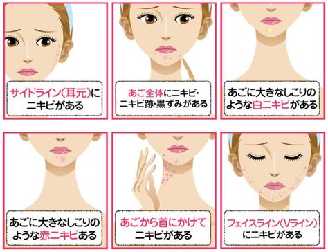 エンビロンお肌無料カウンセリング エルクレスト新宿店 予約サイト