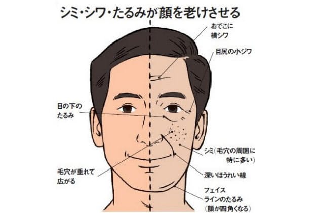 お顔 大きなシミ そばかす シミさよならコース Mens Total Beauty Salon S I D